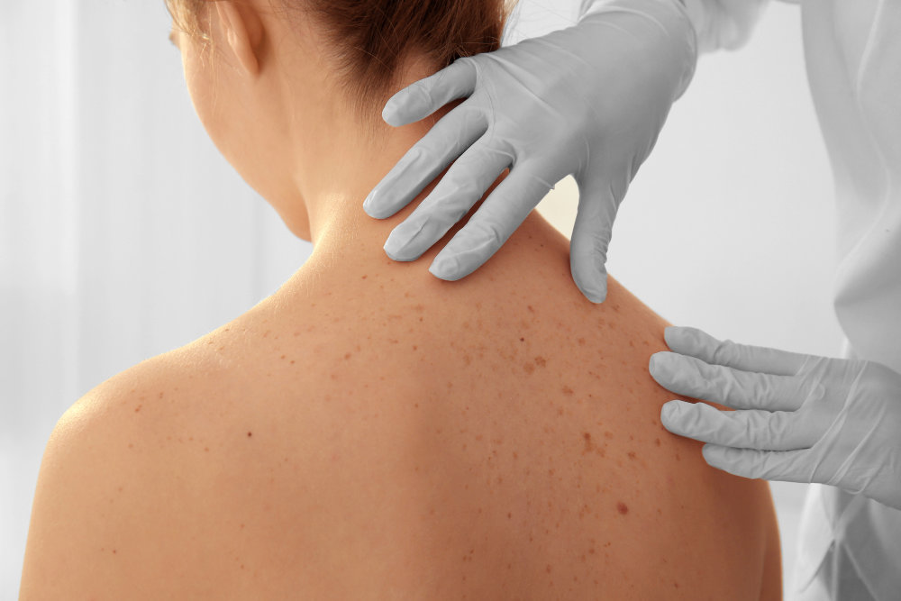Professional skin examination by dermatology specialist in Tarzana, CA