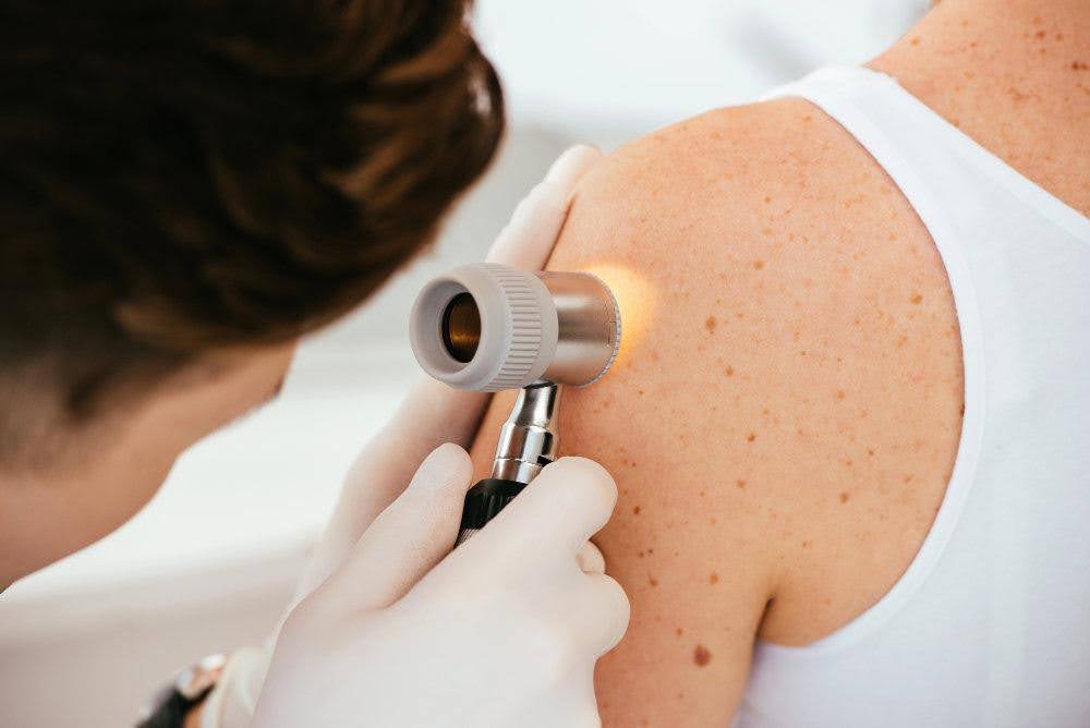Dermatologist performing skin examination at dermatology clinic in Woodland Hills, CA