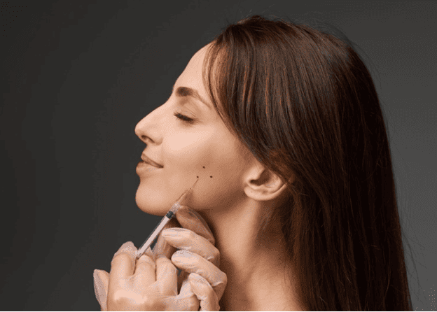 Woman receiving a dermal filler injection along the jawline for TMJ.